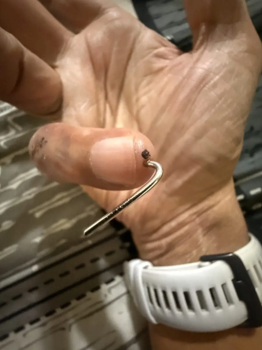 hand post surgery pinky